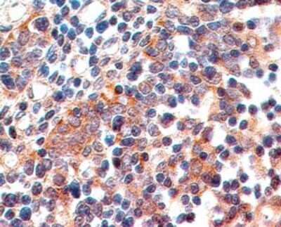 Immunocytochemistry: B7-1/CD80 Antibody (62N3G8) - Azide and BSA Free [NBP2-80588]