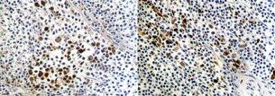 Immunohistochemistry-Paraffin: B7-1/CD80 Antibody (AP-MAB0713) - Azide and BSA Free [NBP2-12178]