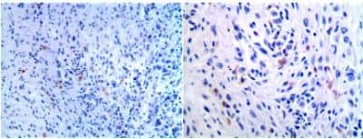 Immunohistochemistry-Paraffin: B7-1/CD80 Antibody (AP-MAB0713) - Azide and BSA Free [NBP2-12178]