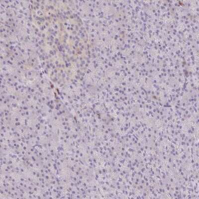 Immunohistochemistry-Paraffin: B7-1/CD80 Antibody [NBP2-48954]