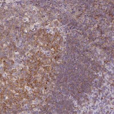 Immunohistochemistry-Paraffin: B7-1/CD80 Antibody [NBP2-48954]