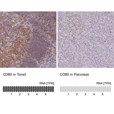 Immunohistochemistry-Paraffin: B7-1/CD80 Antibody [NBP2-48954]