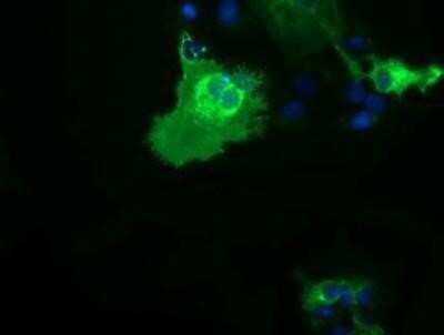 Immunocytochemistry/ Immunofluorescence: B7-1/CD80 Antibody (OTI2E5) - Azide and BSA Free [NBP2-70364]