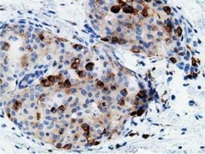 Immunohistochemistry: B7-1/CD80 Antibody (OTI2E5) - Azide and BSA Free [NBP2-70364]