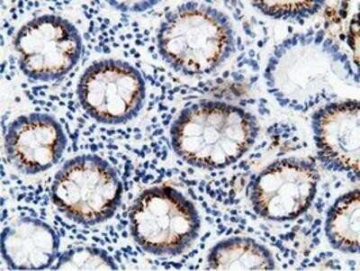 Immunohistochemistry: B7-1/CD80 Antibody (OTI2E5) - Azide and BSA Free [NBP2-70364]