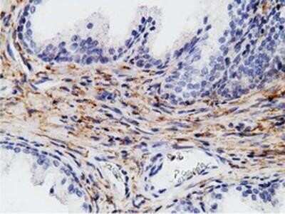Immunohistochemistry: B7-1/CD80 Antibody (OTI2E5) - Azide and BSA Free [NBP2-70364]
