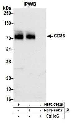 Immunoprecipitation: B7-2/CD86 Antibody (BLR029F) [NBP2-76416]