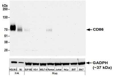 Western Blot: B7-2/CD86 Antibody (BLR029F) [NBP2-76416]