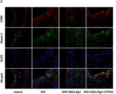 Immunohistochemistry: B7-2/CD86 Antibody (BU63) [NBP2-25208]