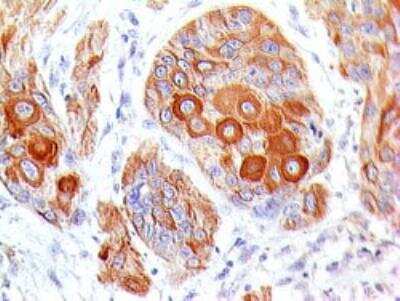 Immunohistochemistry-Paraffin: B7-2/CD86 Antibody (BU63) [NBP2-25208]