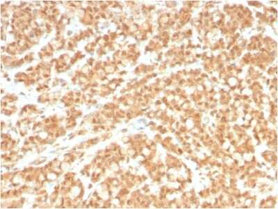 Immunohistochemistry-Paraffin: B7-H2/ICOSLG Antibody (ICOSL/3260) [NBP2-79798]