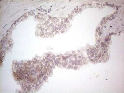 Immunohistochemistry: B7-H2/ICOSLG Antibody (OTI2C5) - Azide and BSA Free [NBP2-71735]