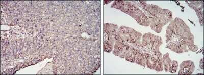 Immunohistochemistry-Paraffin: B7-H3/CD276 Antibody (6A1) - BSA Free [NBP2-37657]