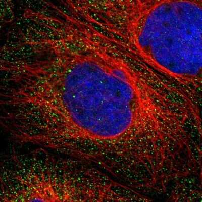 Immunocytochemistry/ Immunofluorescence: B7-H3/CD276 Antibody [NBP1-88966]
