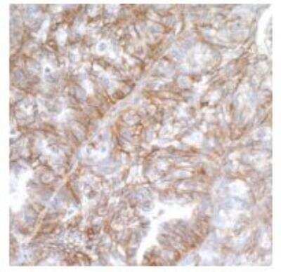 Immunohistochemistry-Paraffin: B7-H3/CD276 Antibody (BLR025F) [NBP3-14669]