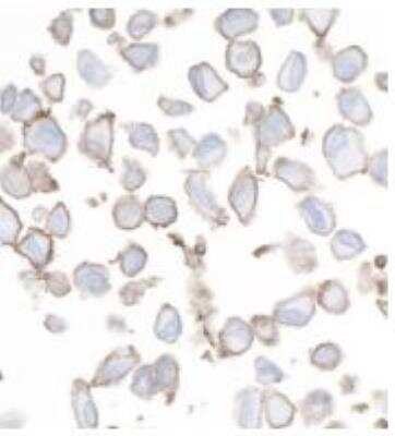 Immunocytochemistry/ Immunofluorescence: B7-H3/CD276 Antibody (BLR025F) [NBP3-14669]