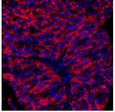 Immunohistochemistry: B7-H3/CD276 Antibody (BLR025F) [NBP3-14669]