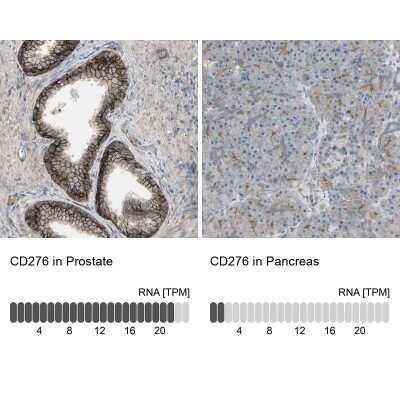 Immunohistochemistry-Paraffin: B7-H3/CD276 Antibody [NBP1-88965]