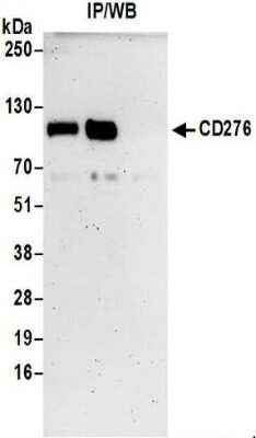 Immunoprecipitation: B7-H3/CD276 Antibody [NBP2-32251]