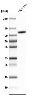 Western Blot: B7-H3/CD276 Antibody [NBP1-88965]