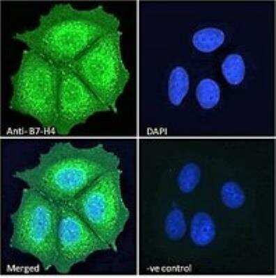 Immunocytochemistry/ Immunofluorescence: B7-H4 Antibody [NBP1-06096]