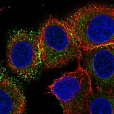 Immunocytochemistry/ Immunofluorescence: B7-H4 Antibody [NBP2-30536]