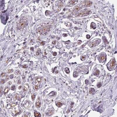 Immunohistochemistry-Paraffin: B7-H4 Antibody [NBP2-30536]