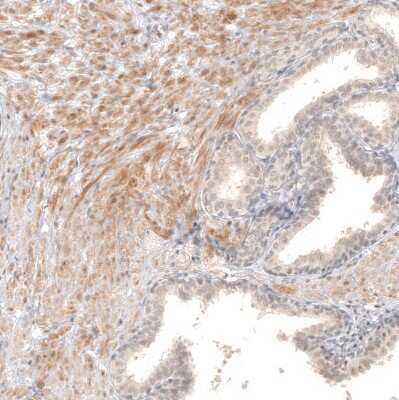 Immunohistochemistry-Paraffin: B7-H6 Antibody [NBP1-91144]