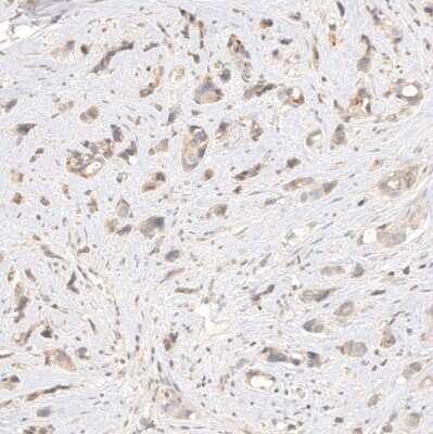 Immunohistochemistry-Paraffin: B7-H6 Antibody [NBP1-91144]
