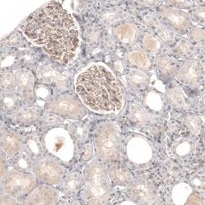 Immunohistochemistry-Paraffin: B7-H6 Antibody [NBP1-91144]