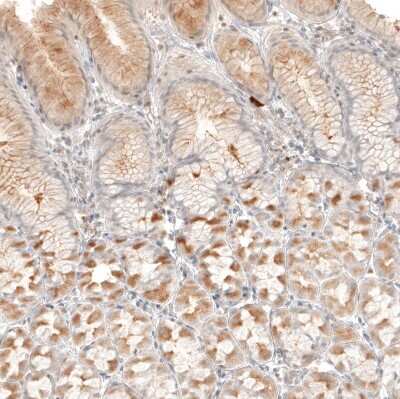 Immunohistochemistry-Paraffin: B7-H6 Antibody [NBP1-91144]