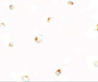 Immunocytochemistry/ Immunofluorescence: B9D1 Antibody - BSA Free [NBP2-81899]
