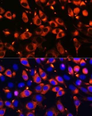 Immunocytochemistry/ Immunofluorescence: B9D1 Antibody - BSA Free [NBP2-92821]