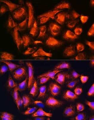 Immunocytochemistry/ Immunofluorescence: B9D1 Antibody - BSA Free [NBP2-92821]
