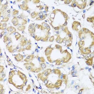 Immunohistochemistry-Paraffin: B9D1 Antibody - BSA Free [NBP2-92821]
