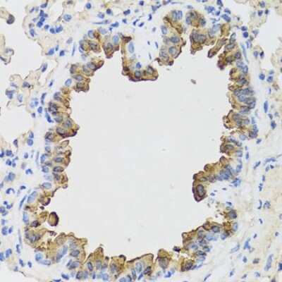 Immunohistochemistry-Paraffin: B9D1 Antibody - BSA Free [NBP2-92821]