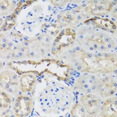 Immunohistochemistry-Paraffin: B9D1 Antibody - BSA Free [NBP2-92821]