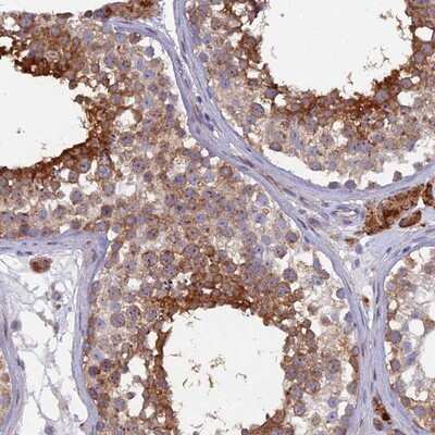 Immunohistochemistry-Paraffin: B9D2 Antibody [NBP1-91694]