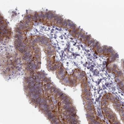 Immunohistochemistry-Paraffin: B9D2 Antibody [NBP1-91694]