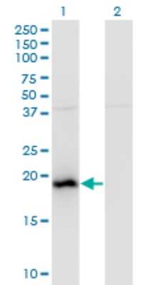 Western Blot: BAALC Antibody (2A2) [H00079870-M01]