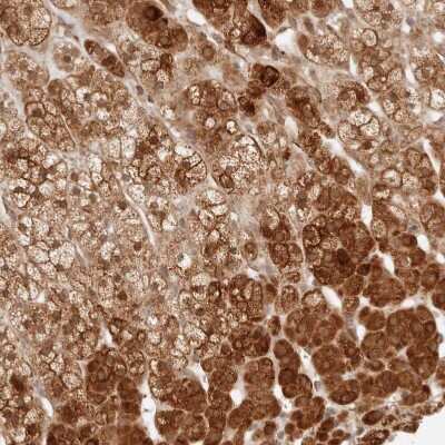 Immunohistochemistry-Paraffin: BAALC Antibody [NBP1-89443]