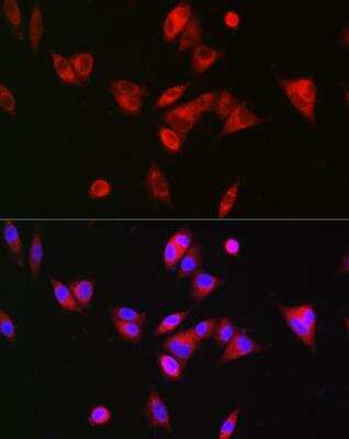 Immunocytochemistry/ Immunofluorescence: BAAT Antibody - BSA Free [NBP2-92503]
