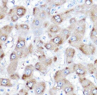 Immunohistochemistry-Paraffin: BAAT Antibody - BSA Free [NBP2-92503]
