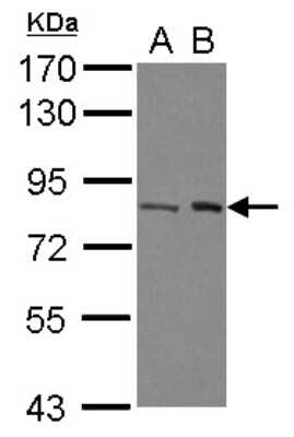 Western Blot: BAAT1 Antibody [NBP2-15536]
