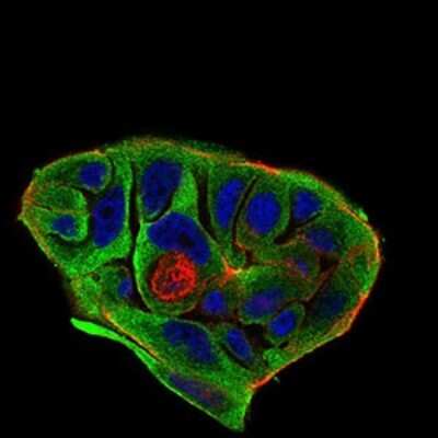 Immunocytochemistry/ Immunofluorescence: BACE-1 Antibody (3C1C3) - BSA Free [NBP2-37261]
