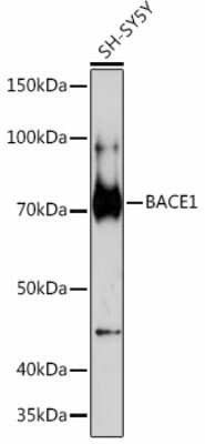 Western Blot: BACE-1 Antibody (7C5T7) [NBP3-15398]