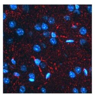 Immunocytochemistry/ Immunofluorescence: BACE-1 Antibody [NBP1-62416]