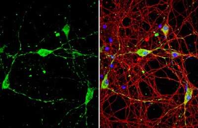Immunocytochemistry/ Immunofluorescence: BACE-1 Antibody [NBP3-13390]
