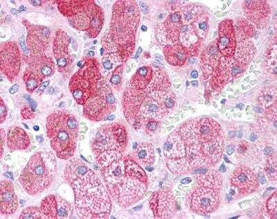Immunohistochemistry-Paraffin: BACE-1 Antibody [NBP1-62416]
