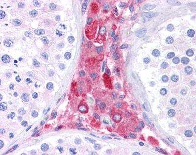 Immunohistochemistry-Paraffin: BACE-1 Antibody [NBP1-62416]